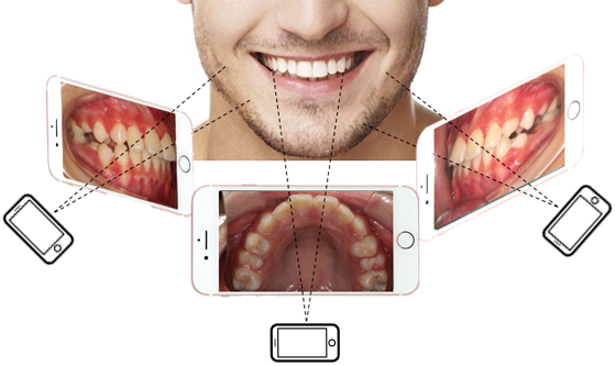 toothmonitoring.png